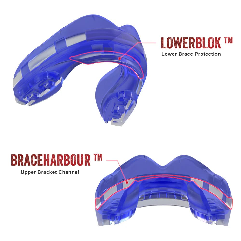 Paradenti Safejawz ORTHO Blu: protezione inferiore e canale per apparecchio superiore.